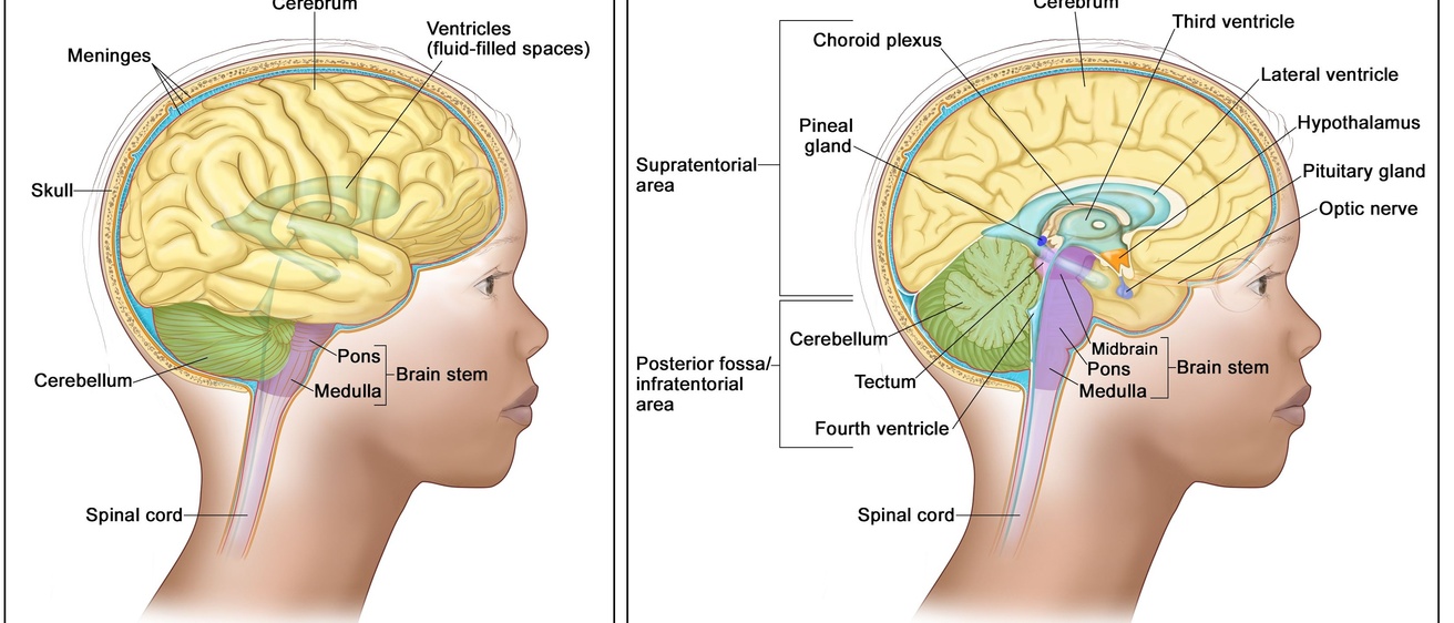 DIPG Diagram