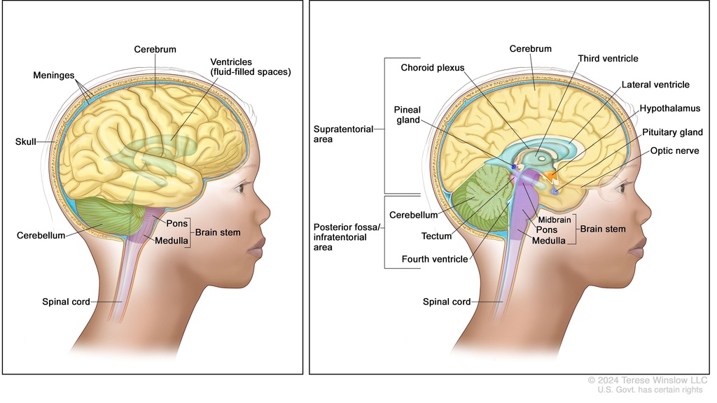 DIPG Diagram